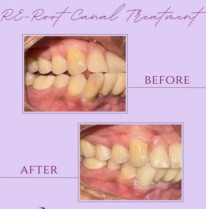 Before-and-after dental case example shared by the clinic